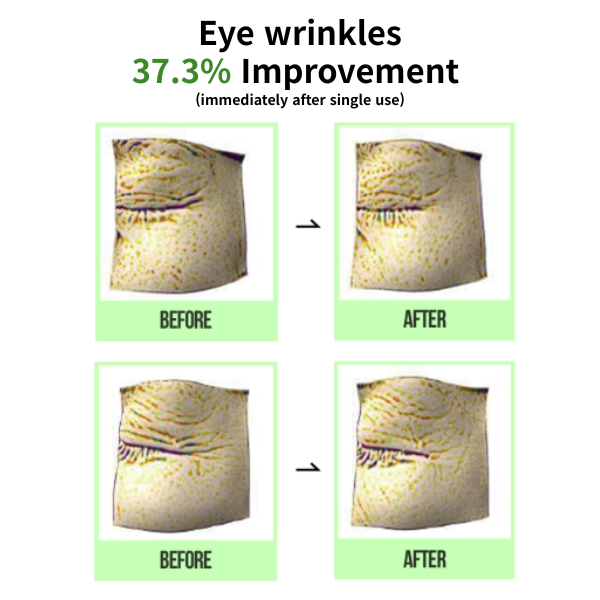 AMOREBASIC All Care Dot Wrinkle Patch