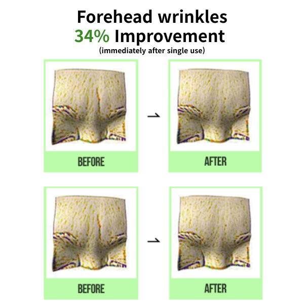 AMOREBASIC All Care Dot Wrinkle Patch