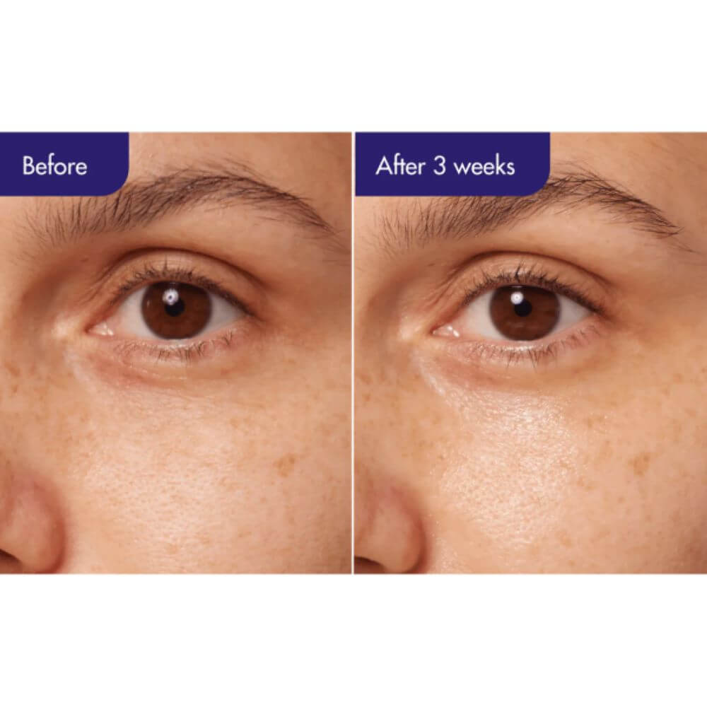 IOPE Retinol Expert 0.3% Wrinkle Corrector – Global AMORE MALL