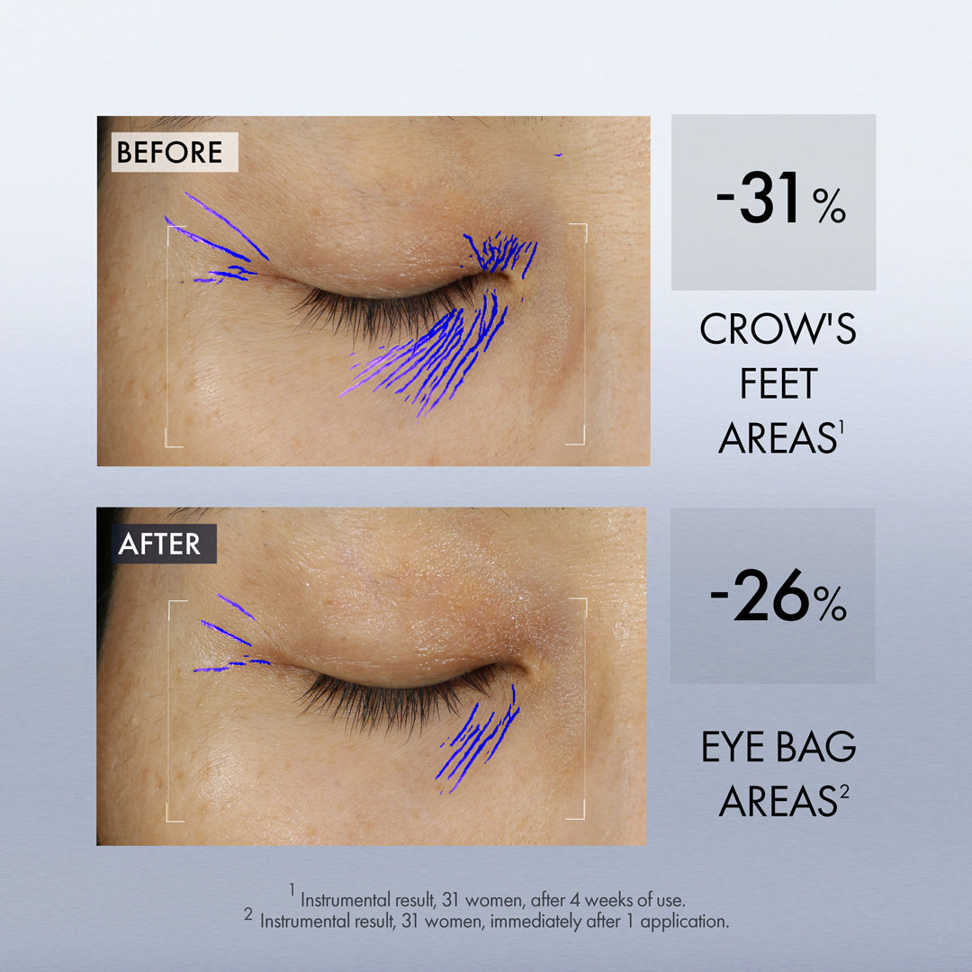 AP BEAUTY M.D. Lift & Firm Dual Eye Treatment 15ml