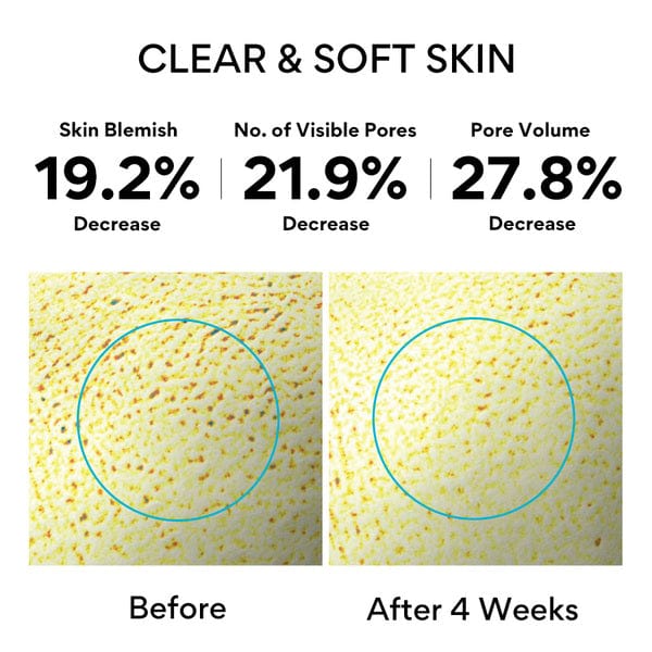 NNISFREE レチノールシカブレミッシュアンプル 30ML 【送料無料注文金額 : 合計 $25(≒¥3,700) 以上】
