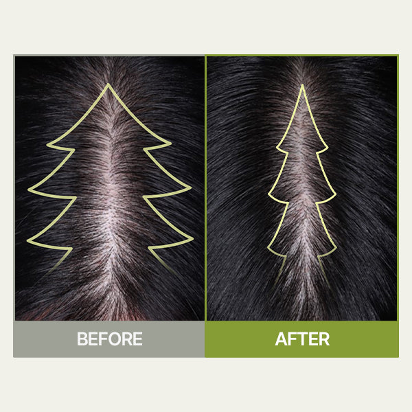 BEST-Ryo Root:Gen Scalp Care Shampoo for Women 353ml